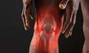 Воспаление коленного сустава лечение народными средствами