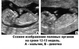 Определение пола ребенка на 12 неделе беременности