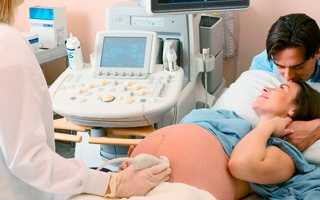 Гестоз в третьем триместре беременности — симптомы и причины, диагностика, методы лечения