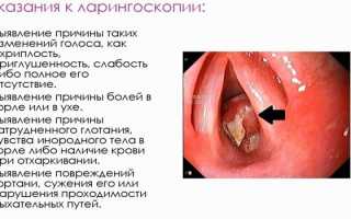 Ларингоскопия прямая и непрямая — как поводится и где можно сделать