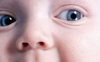 6 видов врожденной катаракты
