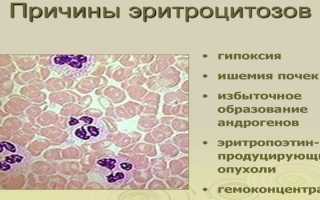 Эритроцитоз у детей и взрослых — причины, симптомы и лечение