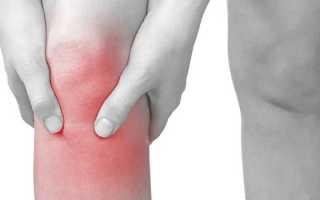 Жидкость в коленном суставе — причины скопления, диагностика, лечение медикаментами и хирургическим путем