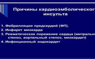 Кардиоэмболический инсульт — механизм возникновения, симптомы, диагностика, лечение и последствия