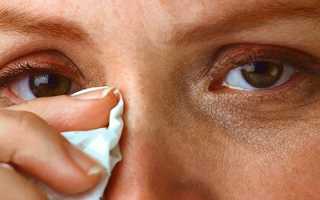 Причины зуда в глазах — симптом возможных заболеваний, методы лечения
