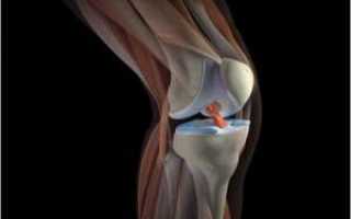 Повреждение коленной чашечки