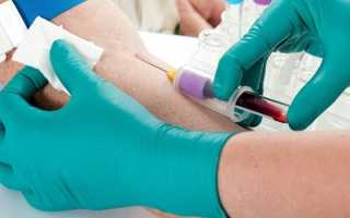Анализ крови на онкомаркеры — показания и подготовка к проведению