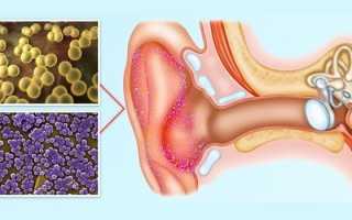 Отит наружного уха — симптомы и лечение