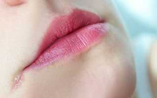 Трещины в уголках губ: причины и лечение заед