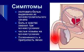 Баланит у мужчин — симптомы и лечение