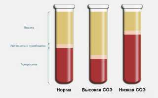 СОЭ у ребенка