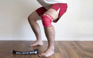 Пателлофеморальный артроз коленного сустава — лечение