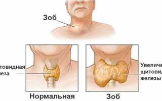 Заболевания щитовидной железы — причины и симптомы, диагностика