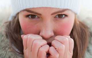 Симптомы аллергии на холод — формы и первые проявления, методы терапии