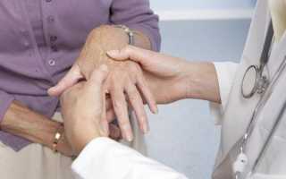 Артрит рук — причины, симптомы, проявления заболевания, методы терапии