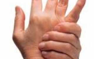 Растяжение большого пальца руки лечение