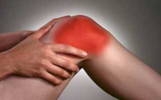 Как лечить ревматоидный артрит коленного сустава
