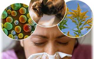 Что необходимо знать об аллергическом рините у взрослых