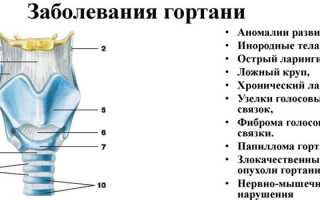 Болезни горла у детей и взрослых — симптомы, диагностика и лечение