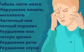 Инсульт в молодом возрасте — причины возникновения, диагностика и лечение