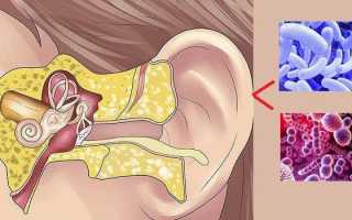 Гнойный отит у ребенка и взрослого — симптомы и лечение